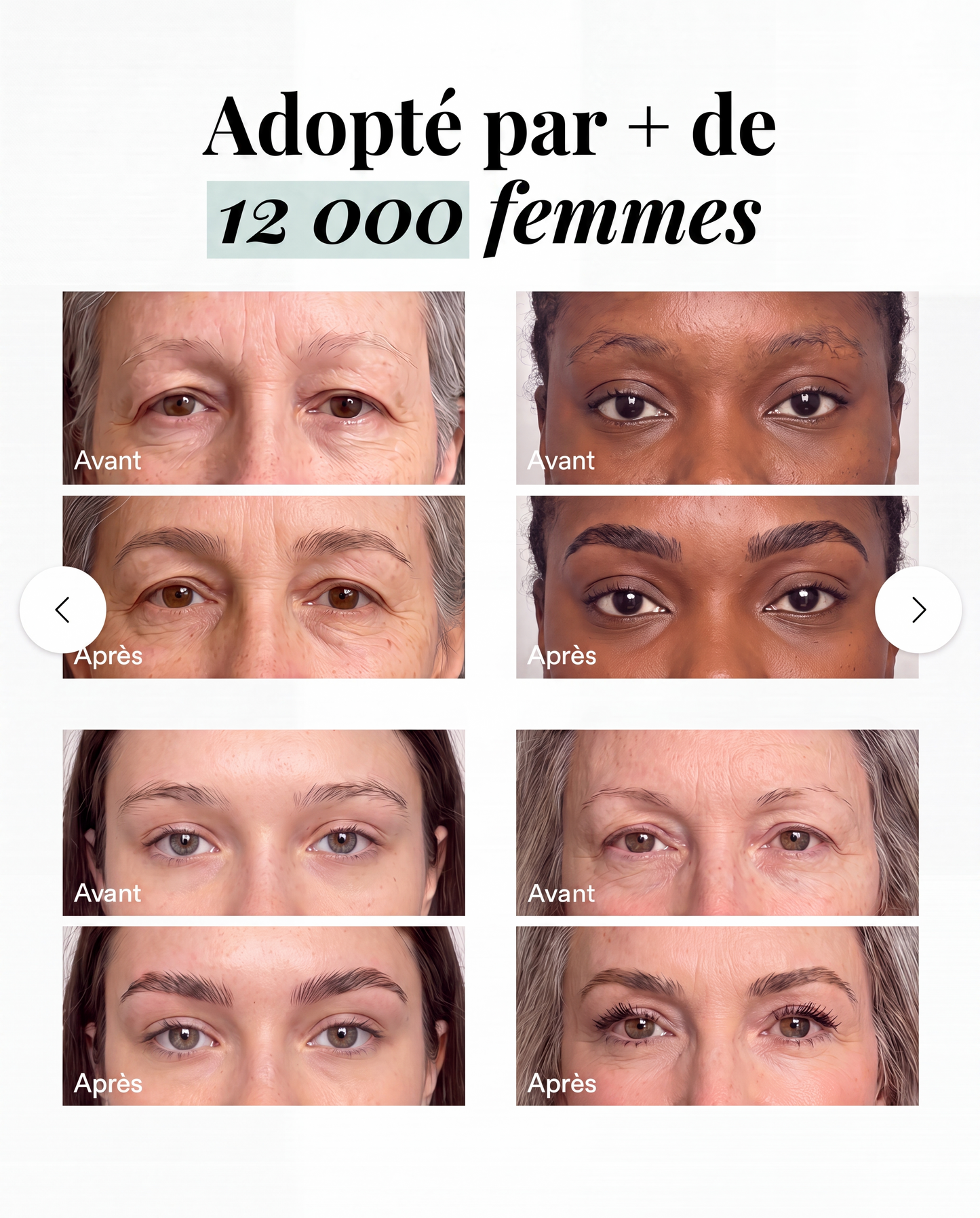 Sérum Croissance Sourcils